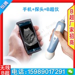 招标诊所b超 全国招商三维彩超