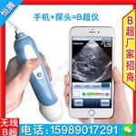 恒腾便携式彩超特价 促销4维b超