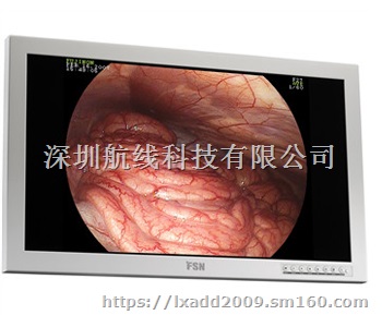 FS-P3102DS医用显示器4K高清FS-C55